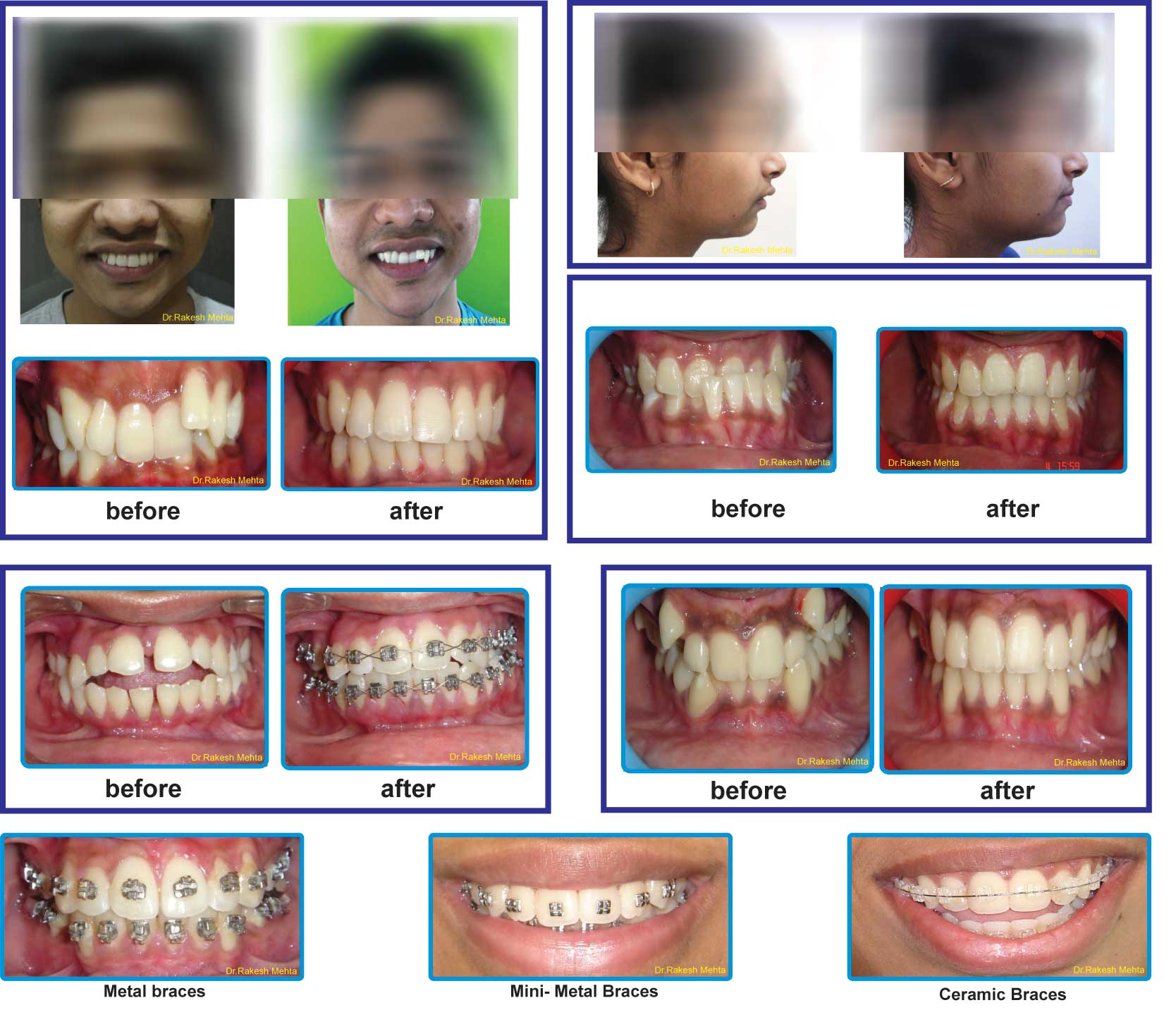 Orthodontics service